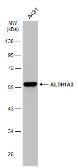 Anti-ALDH1A3 antibody [GT926] used in Western Blot (WB). GTX633822
