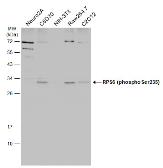 Anti-RPS6 (phospho Ser235) antibody [GT829] used in Western Blot (WB). GTX633823