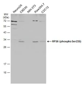Anti-RPS6 (phospho Ser235) antibody [GT829] used in Western Blot (WB). GTX633823