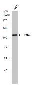 Anti-PYK2 antibody [GT1132] used in Western Blot (WB). GTX633918