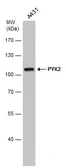 Anti-PYK2 antibody [GT1132] used in Western Blot (WB). GTX633918