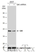 Anti-QKI antibody [GT2612] used in Western Blot (WB). GTX633921