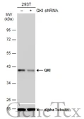 Anti-QKI antibody [GT228] used in Western Blot (WB). GTX633922