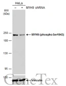 Anti-MYH9 (phospho Ser1943) antibody [GT144] used in Western Blot (WB). GTX633955