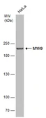 Anti-MYH9 antibody [GT566] used in Western Blot (WB). GTX633960