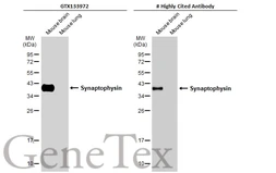 Anti-Synaptophysin antibody [GT2589] used in Western Blot (WB). GTX633972