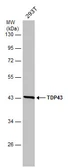 Anti-TDP43 antibody [GT6310] used in Western Blot (WB). GTX633973