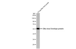 Anti-Zika virus Envelope protein antibody [GT363] (HRP) used in Western Blot (WB). GTX634155-01