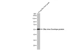 Anti-Zika virus Envelope protein antibody [GT363] used in Western Blot (WB). GTX634155