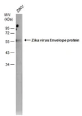 Anti-Zika virus Envelope protein antibody [GT871] (HRP) used in Western Blot (WB). GTX634157-01