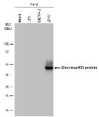 Anti-Zika virus NS1 protein antibody [GT5212] used in Western Blot (WB). GTX634158