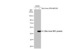 Anti-Zika virus NS1 protein antibody [GT281] used in Western Blot (WB). GTX634159