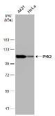 Anti-PYK2 antibody [GT858] used in Western Blot (WB). GTX634162