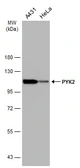 Anti-PYK2 antibody [GT858] used in Western Blot (WB). GTX634162