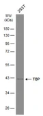 Anti-TBP antibody [GT453] used in Western Blot (WB). GTX634166