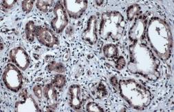 Anti-p53 (phospho Ser46) antibody [GT1018] used in IHC (Paraffin sections) (IHC-P). GTX634168