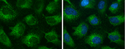 Anti-EEA1 antibody [GT10811] used in Immunocytochemistry/ Immunofluorescence (ICC/IF). GTX634169