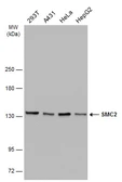 Anti-SMC2 antibody [GT4312] used in Western Blot (WB). GTX634171