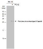 Anti-Porcine circovirus type 2 / PCV2 Capsid antibody [GT1641] used in Western Blot (WB). GTX634172