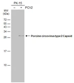 Anti-Porcine circovirus type 2 / PCV2 Capsid antibody [GT1641] used in Western Blot (WB). GTX634172
