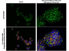 Anti-IL1 beta antibody [GT289] used in Immunocytochemistry/ Immunofluorescence (ICC/IF). GTX634188