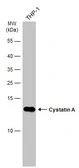 Anti-Cystatin A antibody [GT2264] used in Western Blot (WB). GTX634198