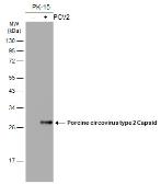 Anti-Porcine circovirus type 2 / PCV2 Capsid antibody [GT863] used in Western Blot (WB). GTX634210