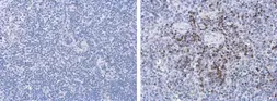 Anti-Porcine circovirus type 2 / PCV2 Capsid antibody [GT863] used in IHC (Paraffin sections) (IHC-P). GTX634210