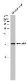 Anti-ANP antibody [GT1068] used in Western Blot (WB). GTX634219