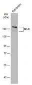 Anti-NF-H antibody [GT114] used in Western Blot (WB). GTX634289