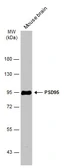 Anti-PSD95 antibody [GT1234] used in Western Blot (WB). GTX634291