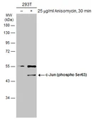 Anti-c-Jun (phospho Ser63) antibody [GT653] used in Western Blot (WB). GTX634322