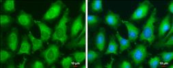 Anti-Human Papillomavirus type 18 E7 antibody [GT881] used in Immunocytochemistry/ Immunofluorescence (ICC/IF). GTX634337