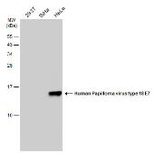 Anti-Human Papilloma virus type 18 E7 antibody [GT881] used in Western Blot (WB). GTX634337