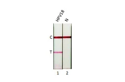 Anti-Human Papillomavirus type 18 E7 antibody [GT881] used in Lateral Flow (Lateral Flow). GTX634337