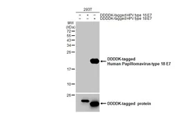 Anti-Human Papillomavirus type 18 E7 antibody [GT881] used in Western Blot (WB). GTX634337