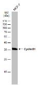 Anti-Cyclin D1 antibody [GT8912] used in Western Blot (WB). GTX634347