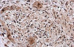 Anti-SP1 antibody [GT2574] used in IHC (Paraffin sections) (IHC-P). GTX634352