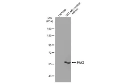 Anti-PAX3 antibody [GT1210] used in Western Blot (WB). GTX634390