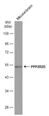 Anti-PPP2R2D antibody [GT577] used in Western Blot (WB). GTX634398