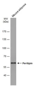 Anti-Perilipin 1 antibody [GT2781] used in Western Blot (WB). GTX634406