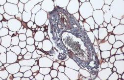 Anti-Perilipin 1 antibody [GT2781] used in IHC (Paraffin sections) (IHC-P). GTX634406