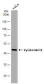 Anti-Cytokeratin 14 antibody [GT985] used in Western Blot (WB). GTX634409