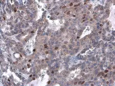 Anti-Cyclin A2 antibody [GT2547] used in IHC (Paraffin sections) (IHC-P). GTX634420