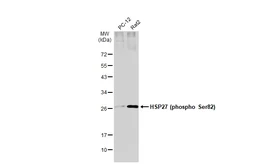 Anti-HSP27 (phospho Ser82) antibody [GT357] used in Western Blot (WB). GTX634421
