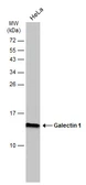 Anti-Galectin 1 antibody [GT2721] used in Western Blot (WB). GTX634454