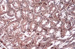 Anti-HSP27 antibody [GT6310] used in IHC (Paraffin sections) (IHC-P). GTX634459