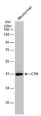 Anti-CTH antibody [GT1657] used in Western Blot (WB). GTX634460