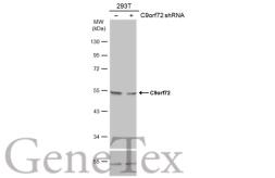 Anti-C9orf72 antibody [GT1553] used in Western Blot (WB). GTX634482