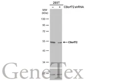 Anti-C9orf72 antibody [GT1553] used in Western Blot (WB). GTX634482